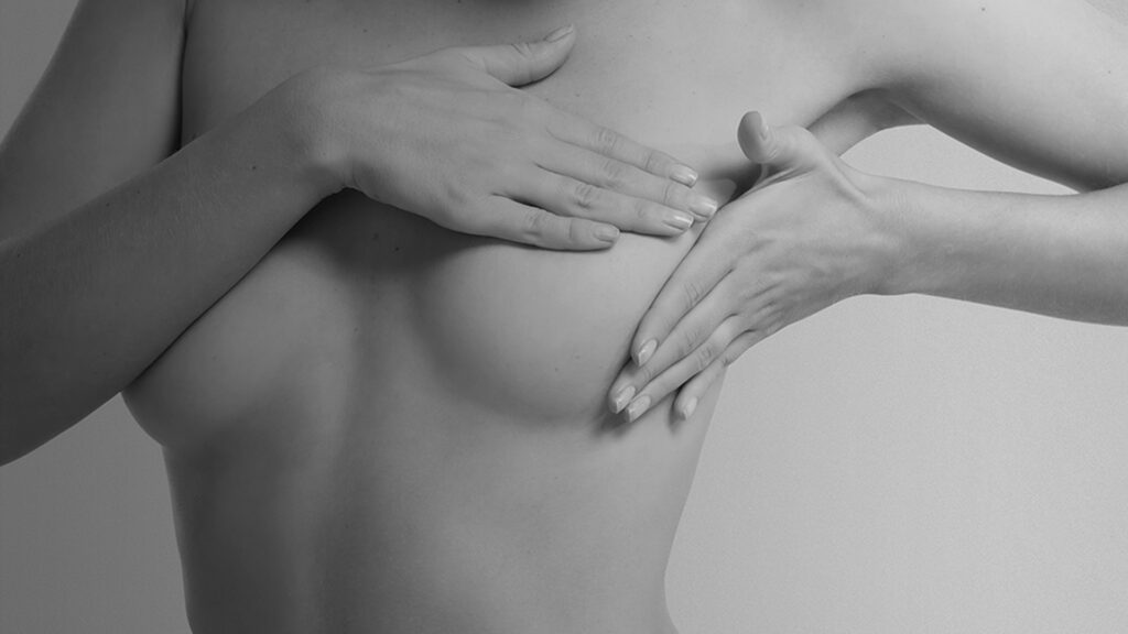 Imagen artística en blanco y negro de manos femeninas sobre el pecho, asociada a mastopexia o reducción mamaria